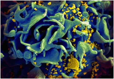 www.17c.con爱网站开发出靶向HIV病毒库的Dual-CAR-T细胞,为治愈HIV感染奠定基础